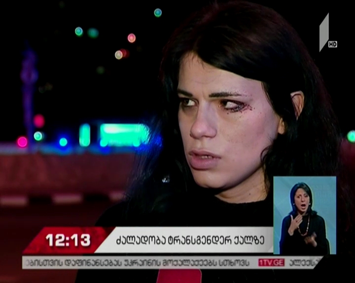 შსს: ტრანსგენდერი ქალის ცემის ფაქტზე საგამოძიებო მოქმედებები მიმდინარეობს