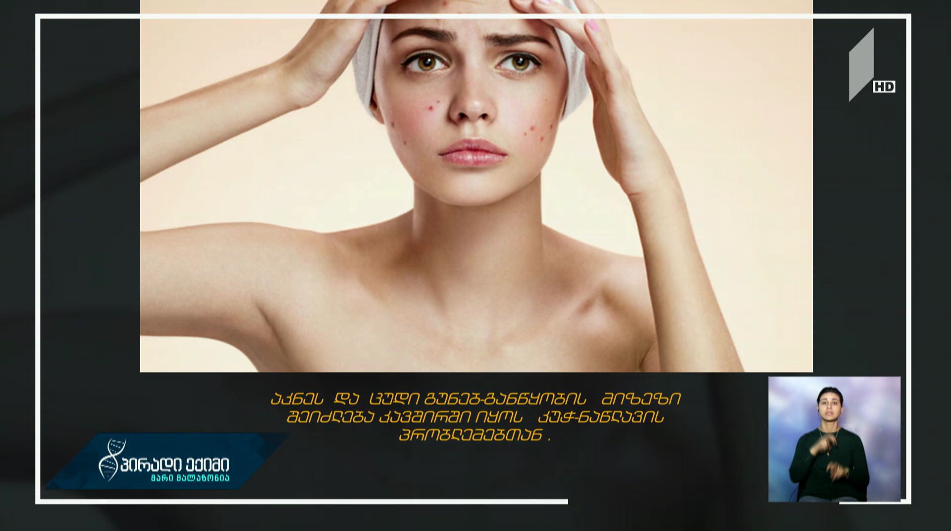 აკნეს და უგუნებობის მიზეზი შეიძლება კავშირში იყოს კუჭ-ნაწლავის პრობლემებთან