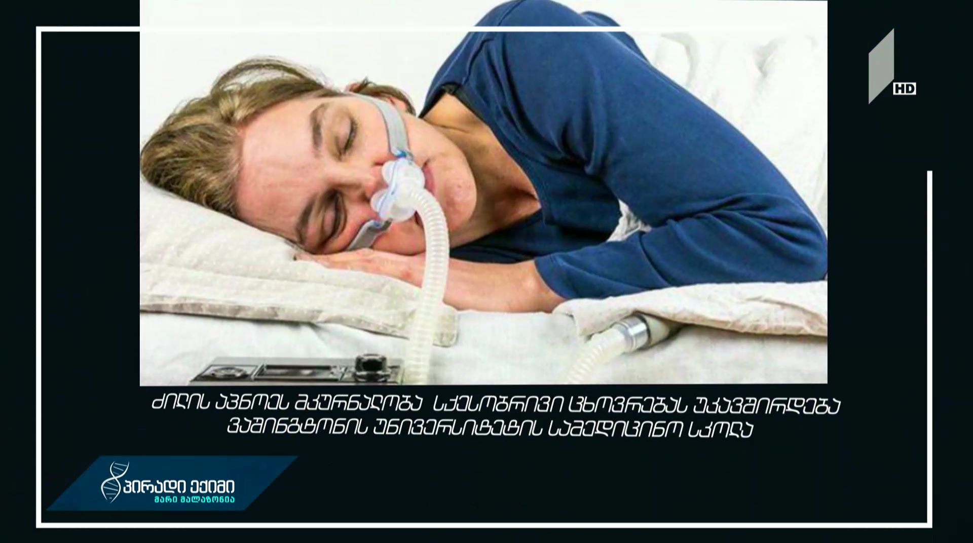 ძილის აპნოეს მკურნალობა სქესობრივ ცხოვრებას უკავშირდება - ვაშინგტონის უნივერსიტეტის სამედიცინო სკოლა