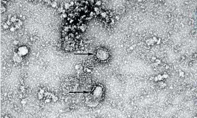 ჩინეთში ახალი კორონავირუსით გარდაცვლილთა რიცხვი 25-მდე გაიზარდა
