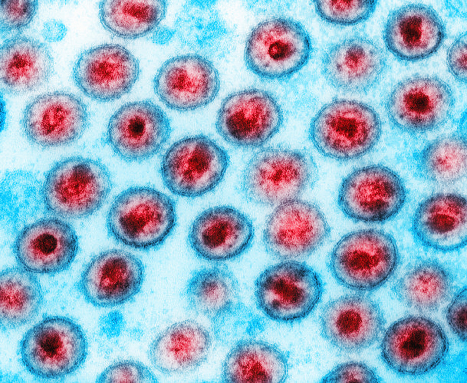 ბრაზილიაში უცნაური ვირუსი აღმოაჩინეს, რომელსაც მეცნიერებისთვის სრულიად უცნობი გენები აქვს