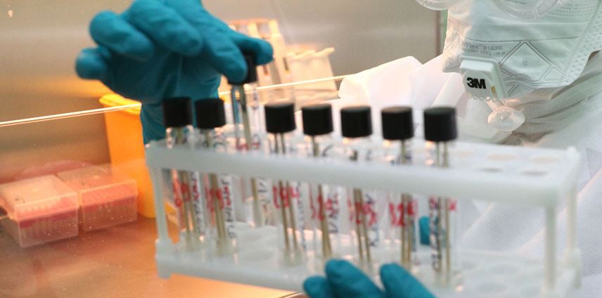 İranda son 24 saat ərzində koronavirusun 2 596 halı təsdiq olundu, 87 insan vəfat etdi