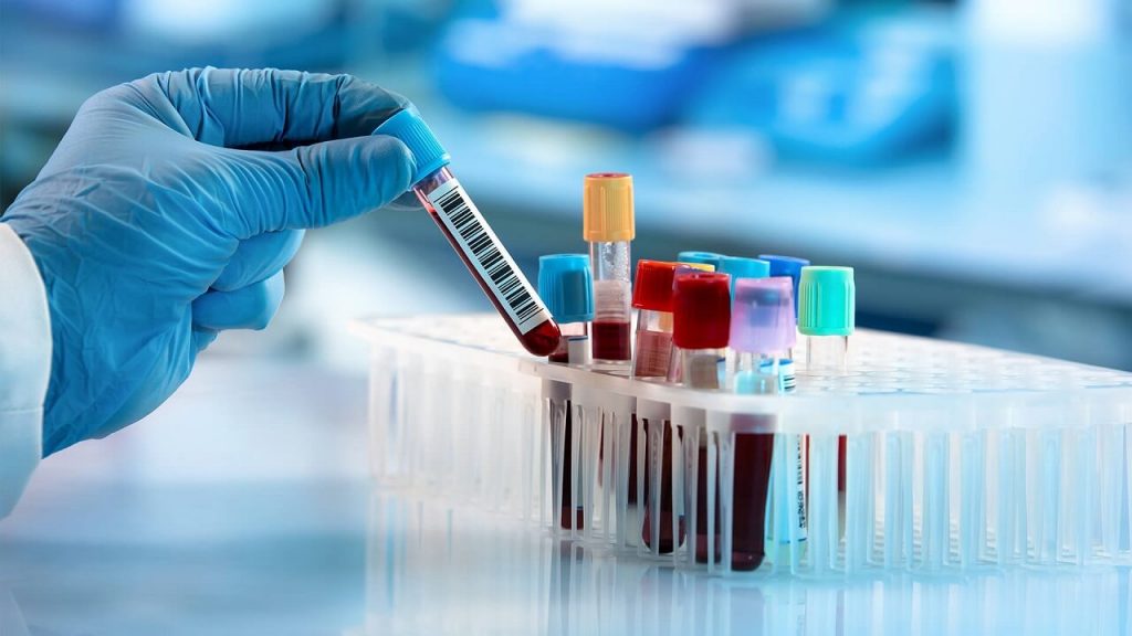 სისხლის ახალი ტესტი ხუთი ტიპის კიბოს წლებით ადრე აფიქსირებს, ვიდრე სტანდარტული დიაგნოსტიკა — #1tvმეცნიერება