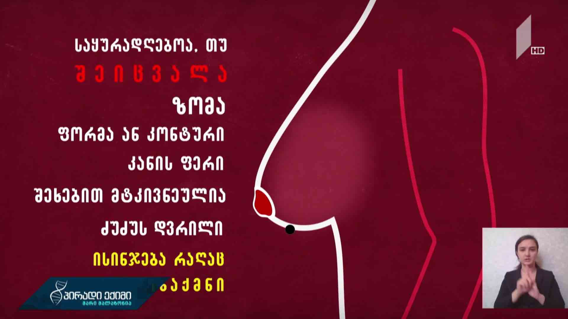 #პირადიექიმისრჩევები სარძევე ჯირკვლის შეფასება ასაკის და სქესის შესაბამისად