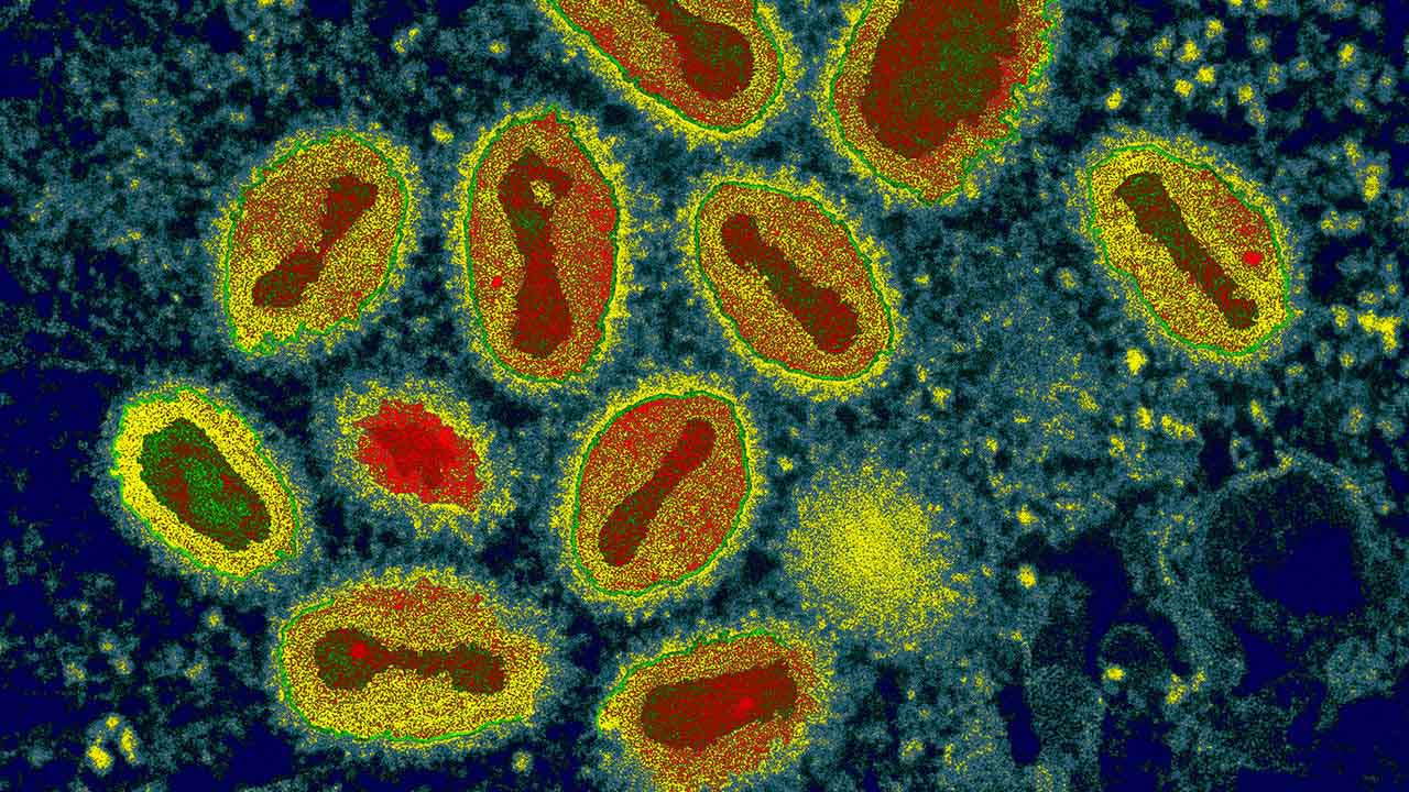 ყვავილის ვირუსის შესახებ საუკუნეების განმავლობაში წარმოებული ჩანაწერები გვიჩვენებს, როგორ გაქრა ეს მომაკვდინებელი დაავადება — #1tvმეცნიერება