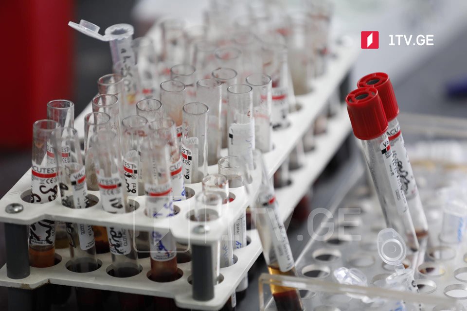 Gürcüstanda 2 796 yeni koronavirus halı aşkarlanıb, 2088 nəfər sağalıb