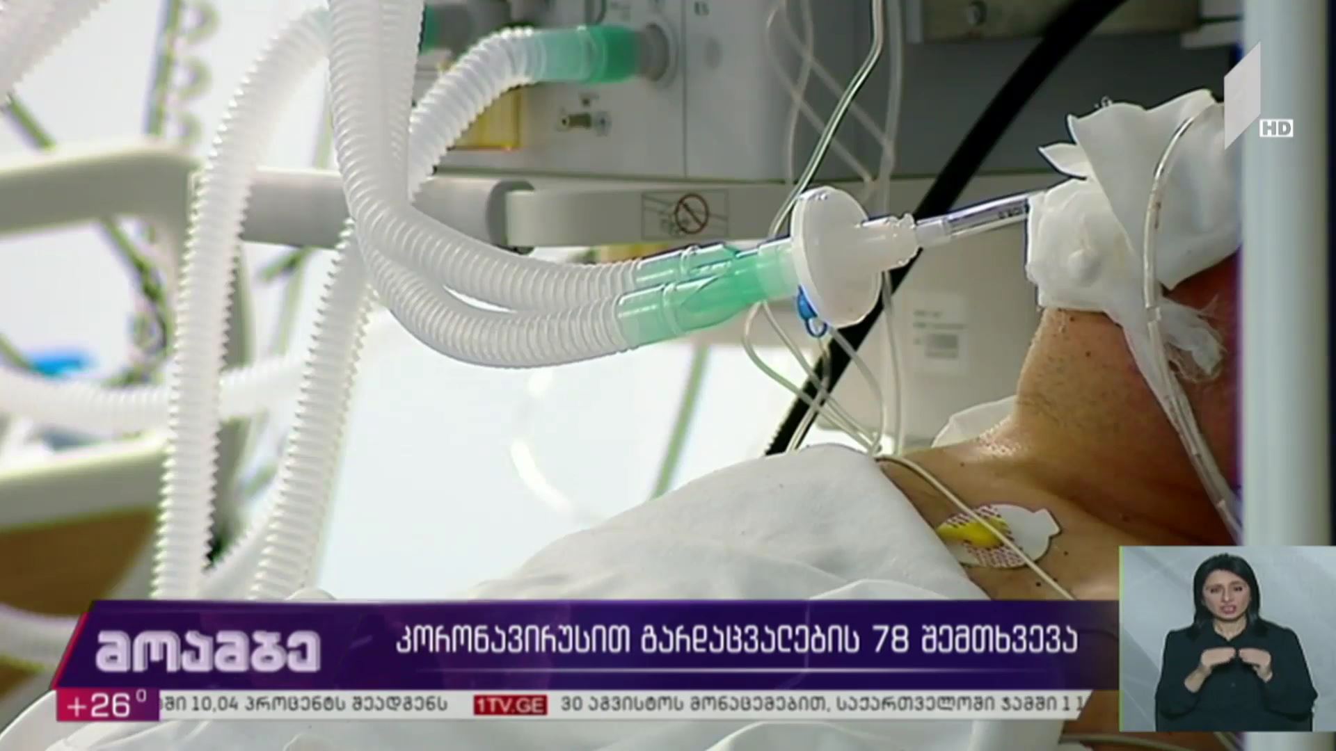 კორონავირუსით გარდაცვალების 78 შემთხვევა საქართველოში