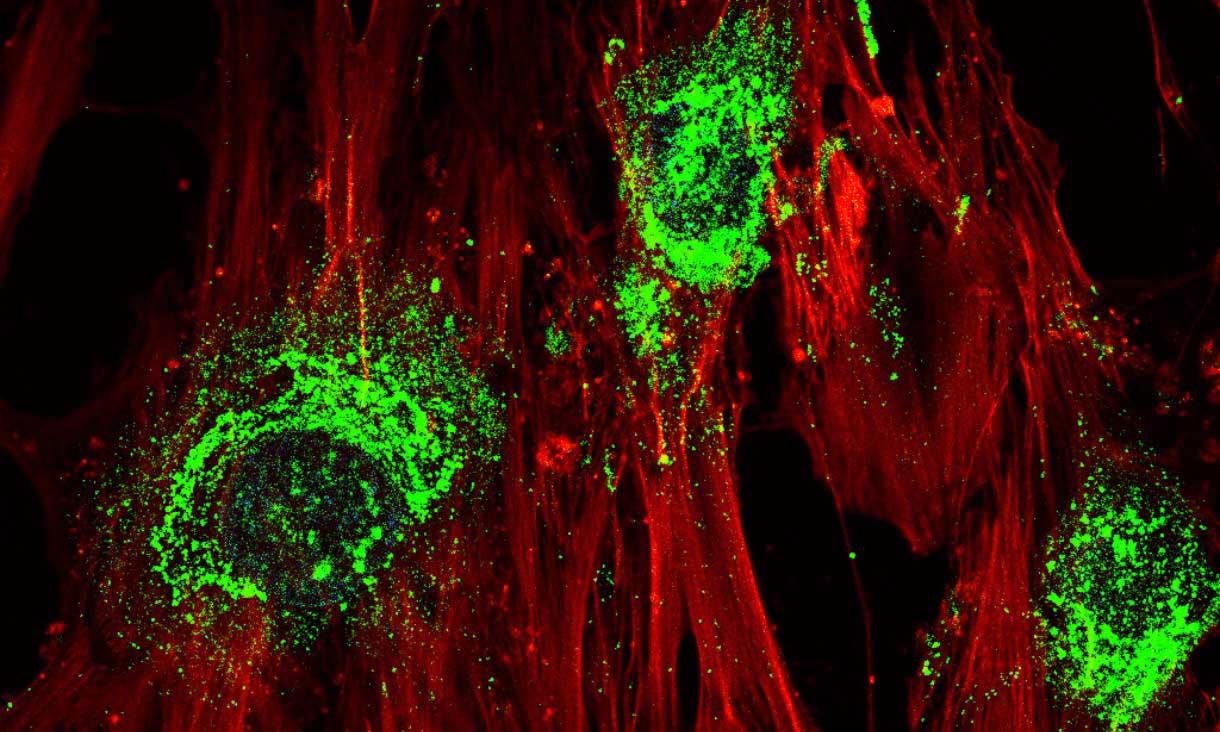 ბგერის ტალღების გამოყენებით, მეცნიერებმა ღეროვანი უჯრედები ძვლის უჯრედებად გარდაქმნეს — #1tvმეცნიერება