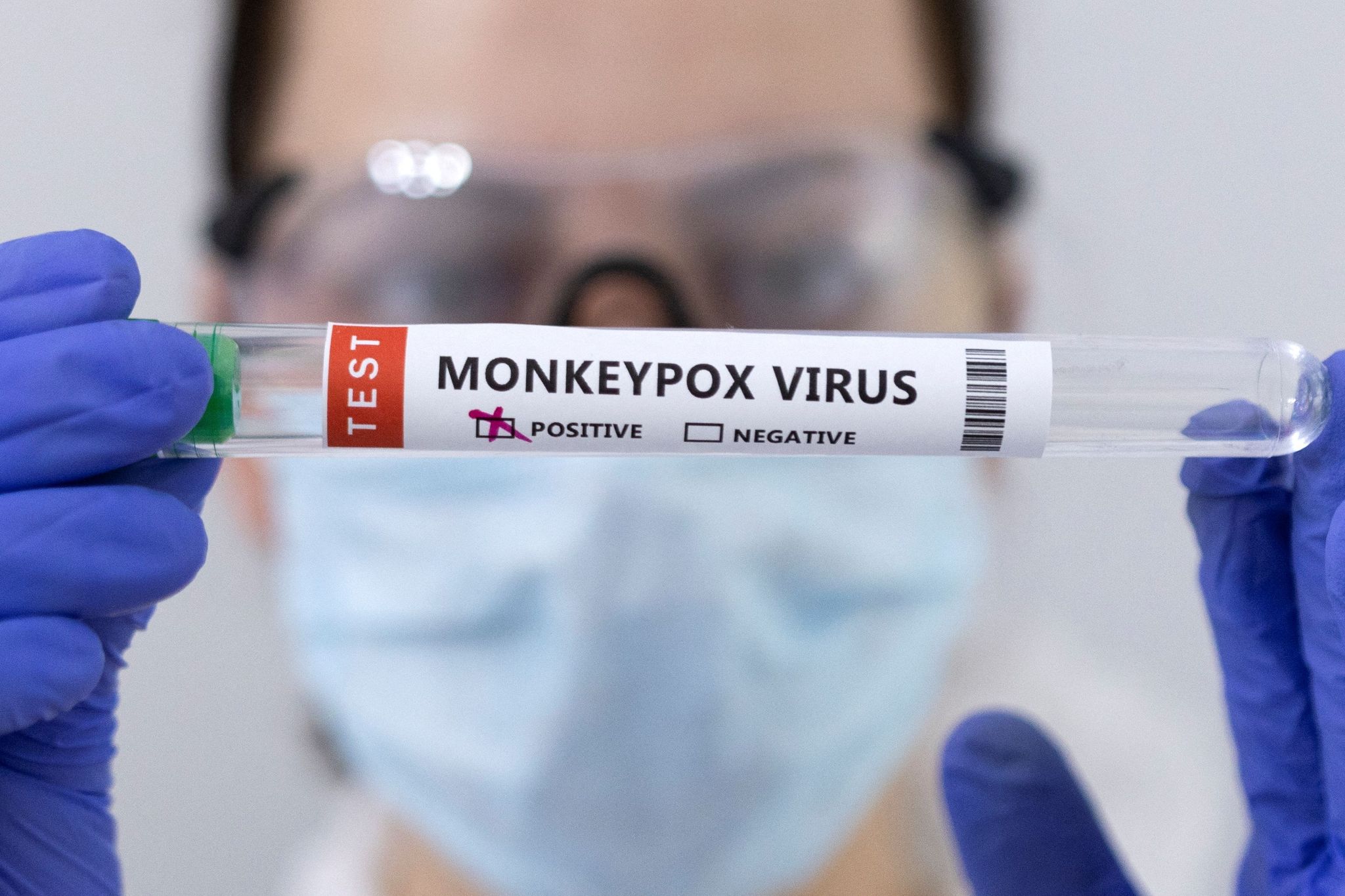 #სახლისკენ - რა უნდა ვიცოდეთ Monkeypox-ის შესახებ