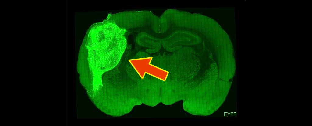 მეცნიერებმა ვირთხების ტვინში ადამიანის თავის ტვინის უჯრედები გაზარდეს — #1tvმეცნიერება