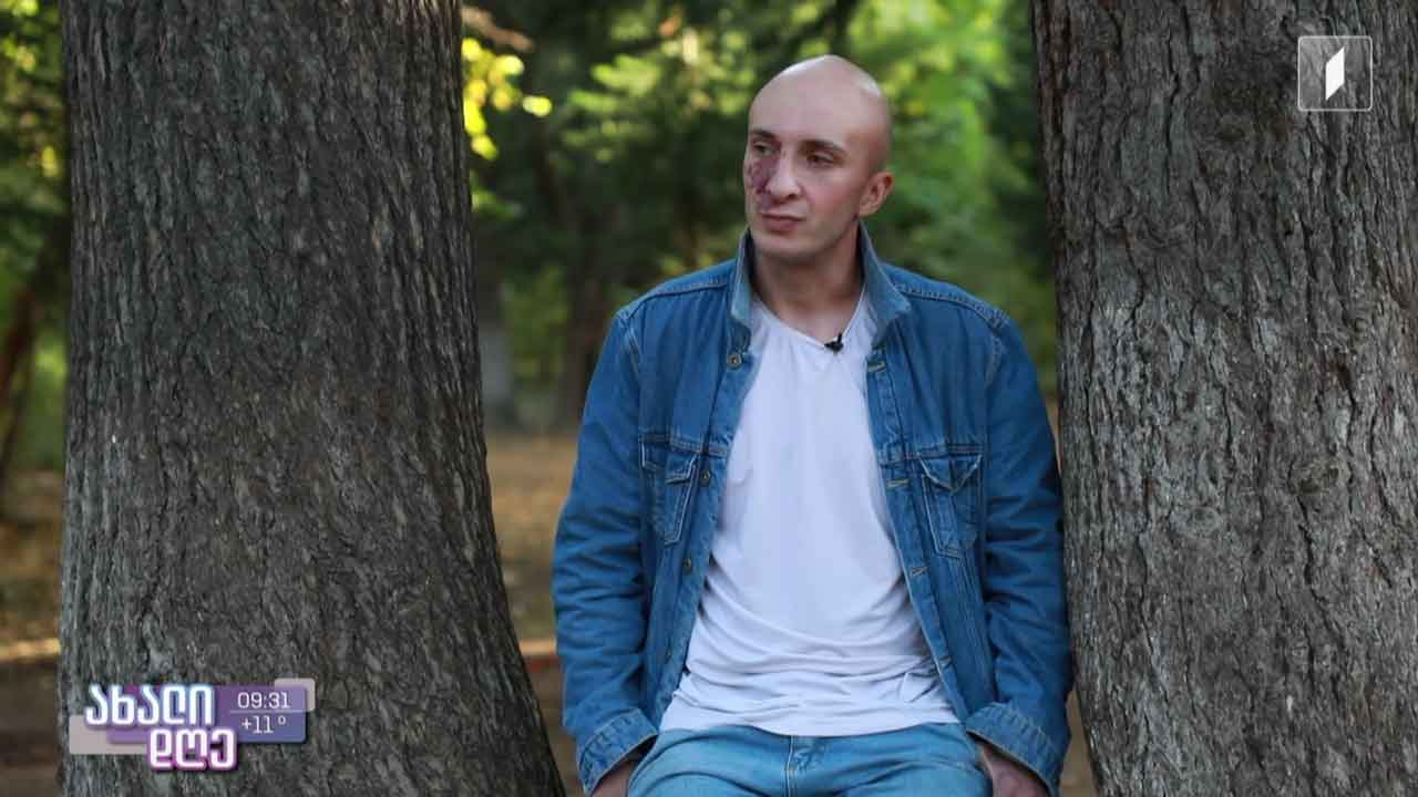 განსხვავებული გარეგნობა და საზოგადოების სტერეოტიპები
