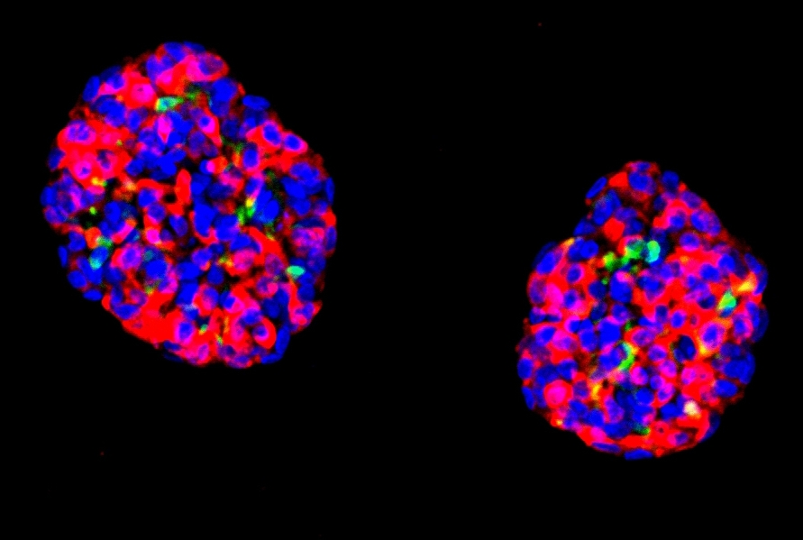 Scientists Transformed Stem Cells into Insulin-Producing Cells That Cured Diabetes in Mice — #1tvScience
