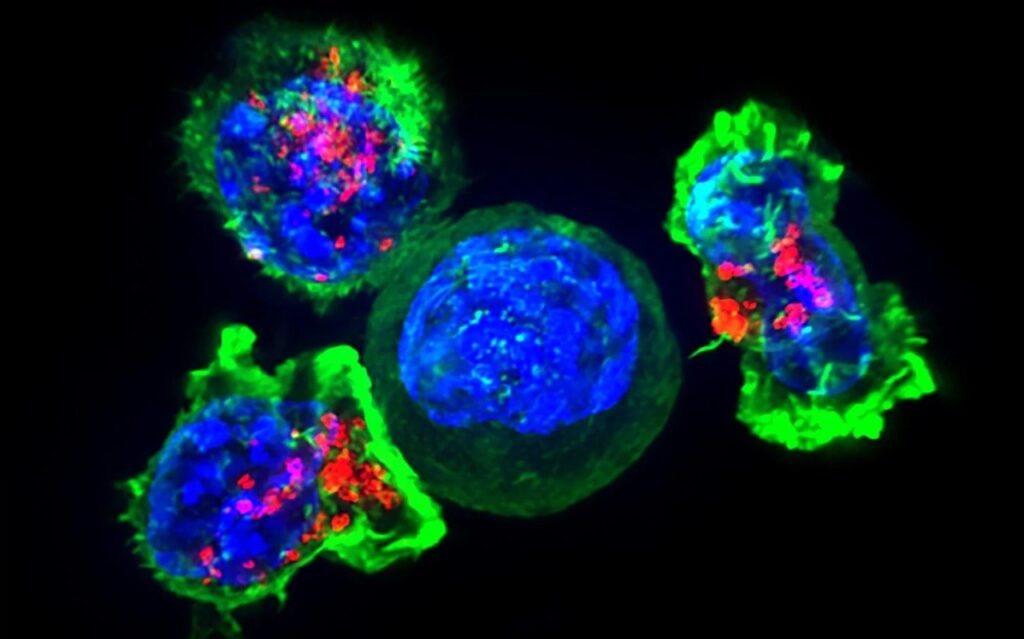 მეცნიერებმა კიბოს უჯრედების გავრცელების ახალ, მოულოდნელ გზას მიაგნეს — #1tvმეცნიერება