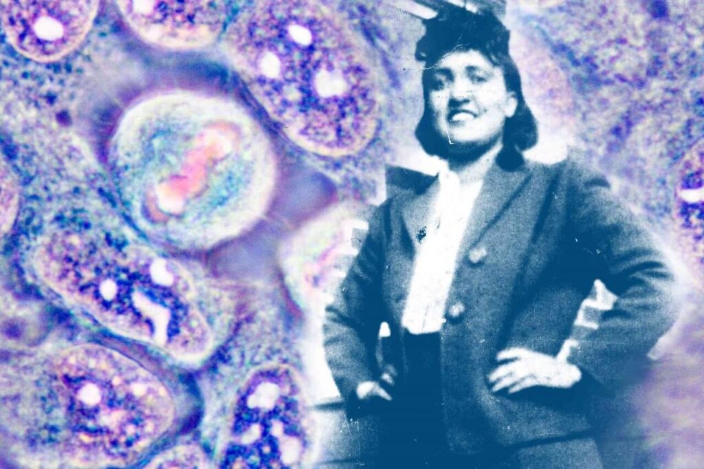 ვინ იყო ჰენრიეტა ლაკსი — ქალი, რომლის უკვდავმა უჯრედებმა მედიცინა სამუდამოდ შეცვალა #1tvმეცნიერება