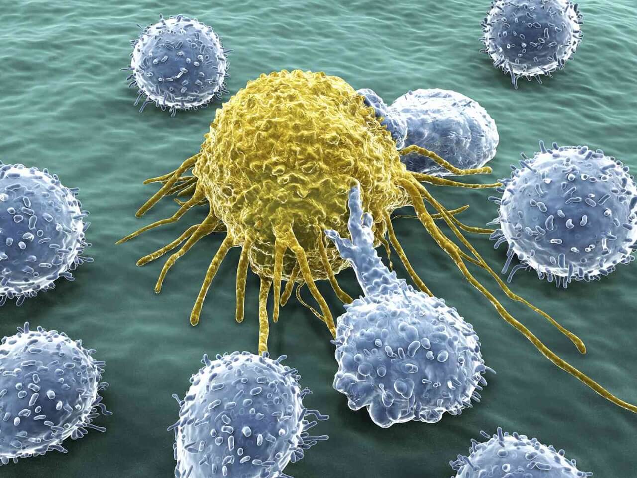 Immune cells that destroy many different late-stage cancers discovered — #1tvScience