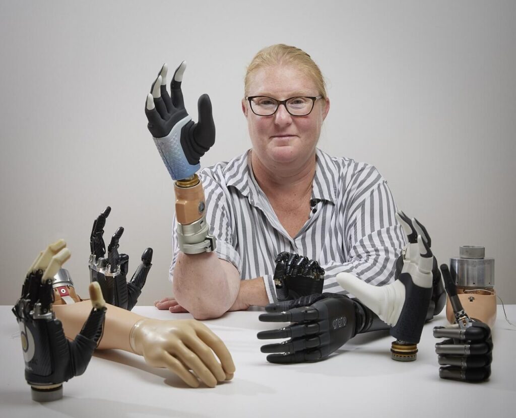 რევოლუციური ხელის პროთეზი ქალის ძვლებს, კუნთებსა და ნერვებს შეეზარდა — #1tvმეცნიერება