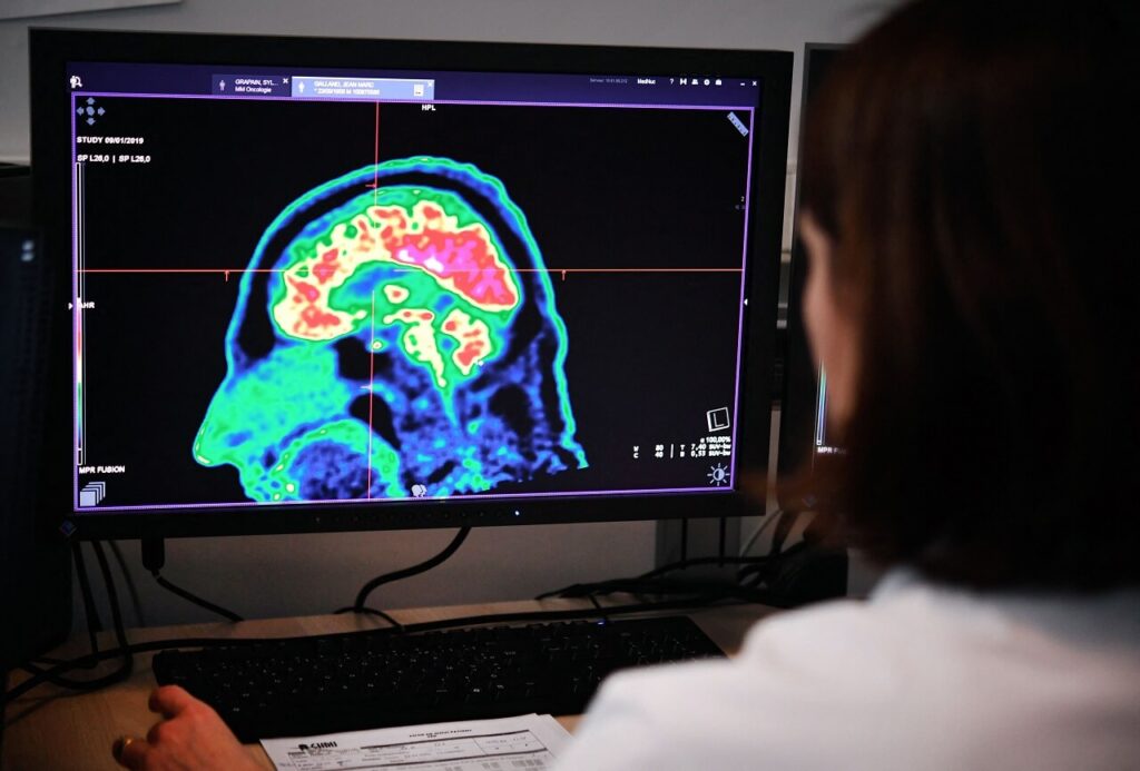 პირველად მსოფლიოში, 13 წლის ბავშვი თავის ტვინის იშვიათი კიბოსგან სრულად განიკურნა — #1tvმეცნიერება