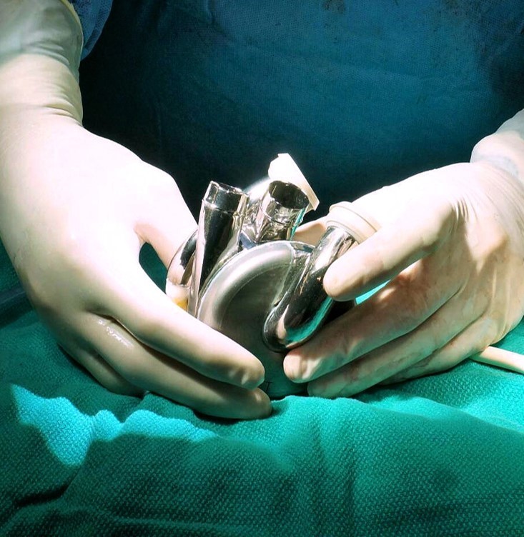 1722591765-BiVACOR%C2%AE-Total-Artificial-Heart-Surgery_Credit-BiVACOR.jpg