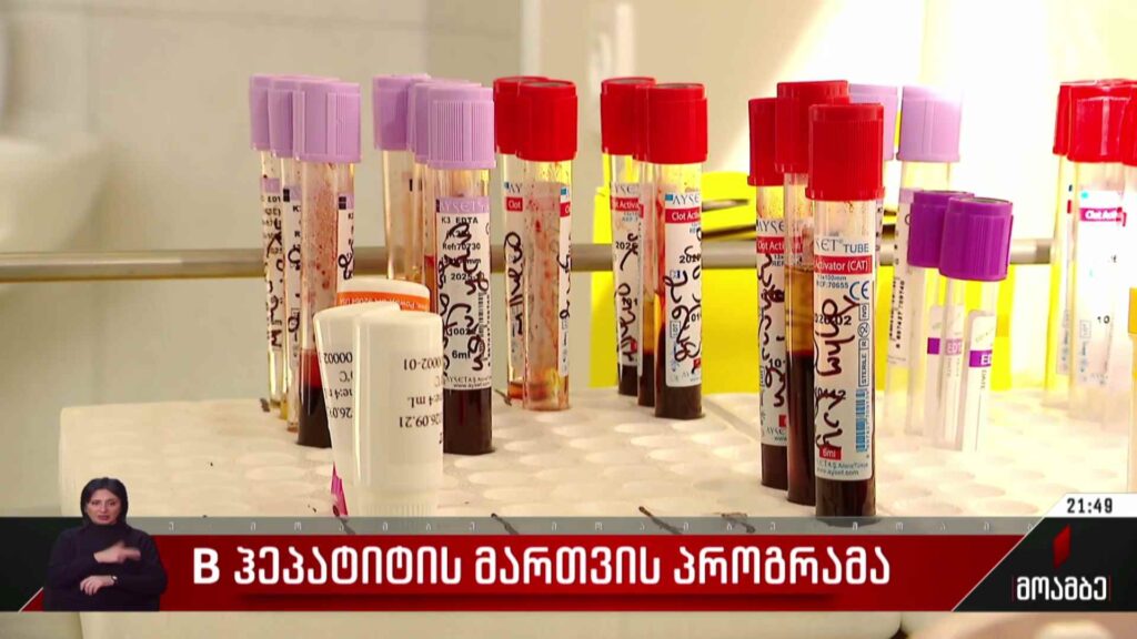 B ჰეპატიტის მართვის პროგრამა