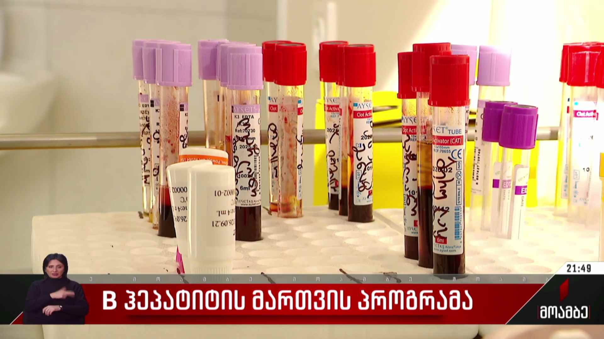 B ჰეპატიტის მართვის პროგრამა