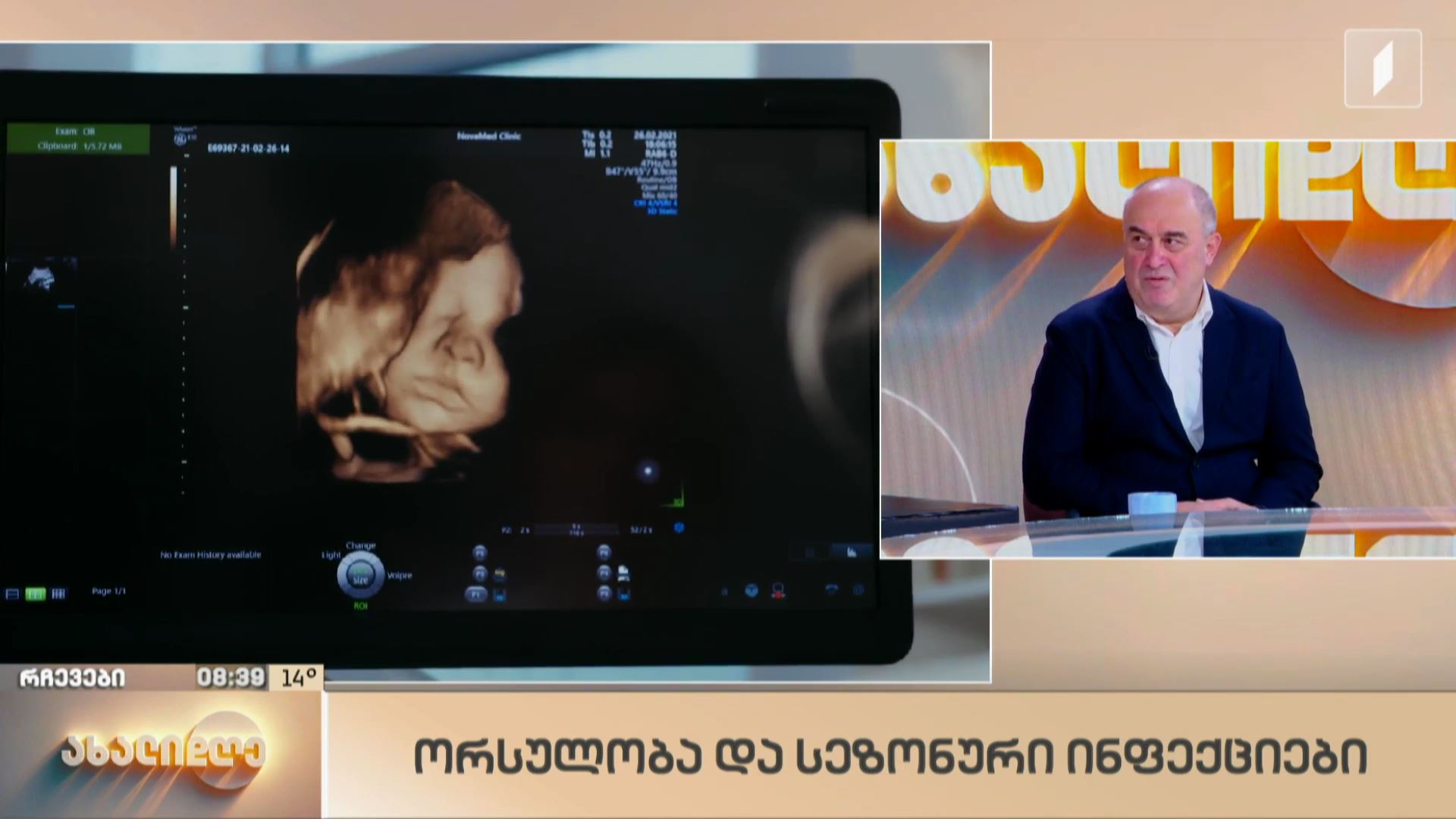 ორსულობა და სეზონური ინფექციები