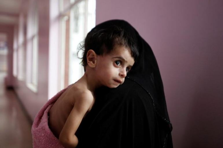 Yemen conflict: UN official warns of world's biggest famine