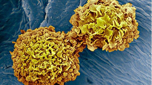 BBC - Ученые открыли универсальный анализ крови на рак