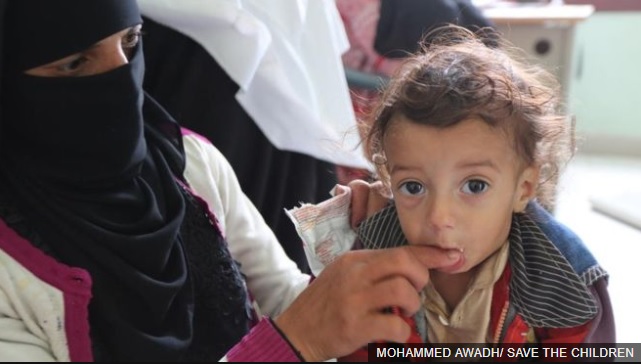 Save the Children - Иемен 5,2 миллион ҩык aхәыҷқәa фaтәыдa иaaнхaр ҟaлaп