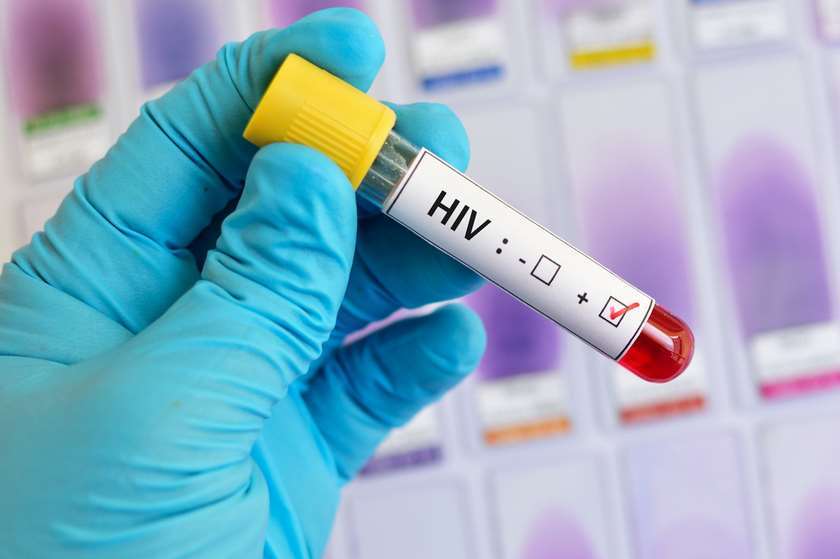 Վրաստանում այս տարի գրանցվել է ՄԻԱՎ-ի 87 նոր դեպք