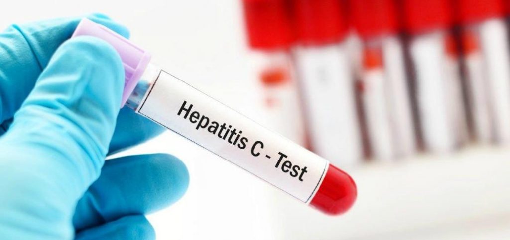 Правительство планирует расширить ареал скрининга гепатита C