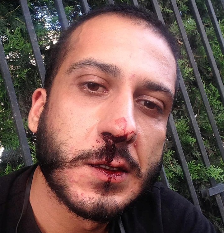 Правоохранители избили и задержали журналиста Первого канала Грузии Нику Мухигулашвили, разбита видеокамера