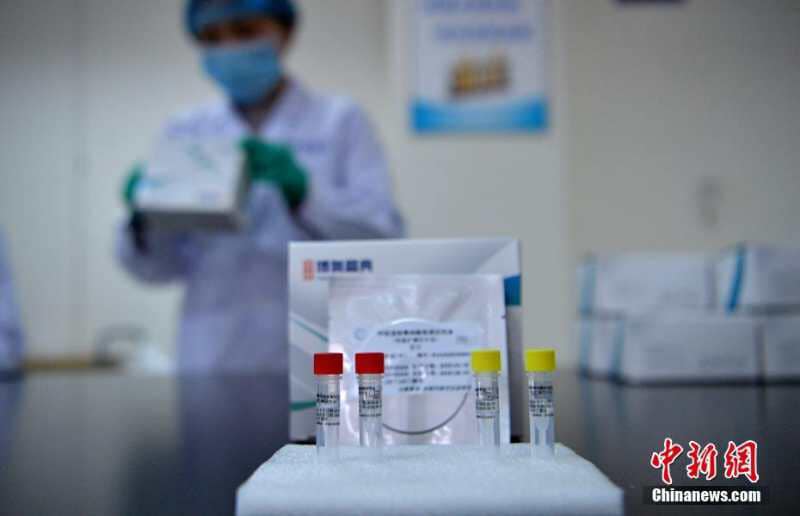China to hand over to Georgia tests on coronavirus free of charge