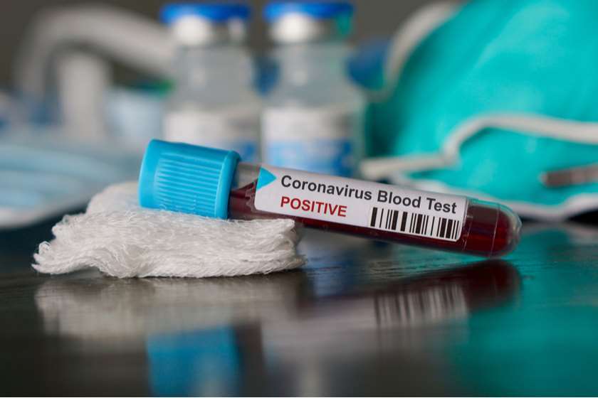 Число инфицированных коронавирусом в Армении возросло до 72-х человек