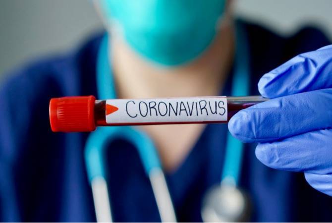 В Армении 266 человек инфицированы коронавирусом