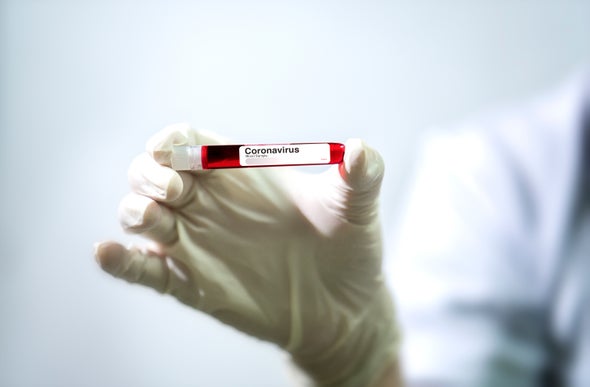 Belarus reports first coronavirus death