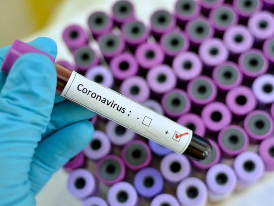 Niderlanlarda koronavirus ilə həlak olanların sayı 1 766-a qədər artdı