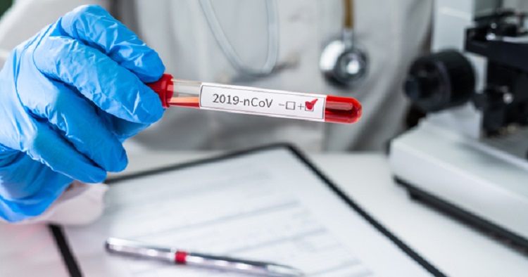 Ermənistanda son bir gündə koronavirusun 65 yeni halı qeydə alındı
