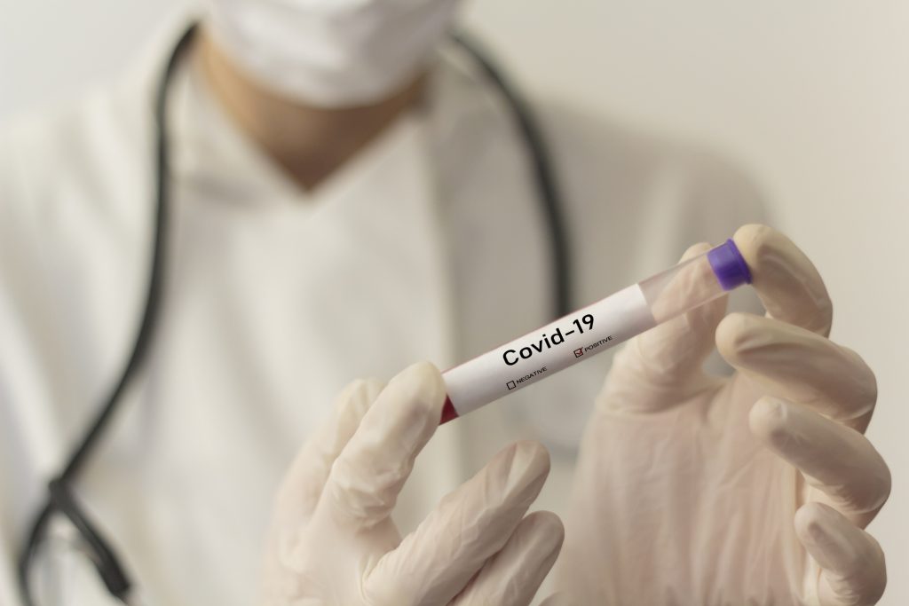 С завтрашнего дня в Грузии PCR-тестирование будет доступно еще в пяти лабораториях