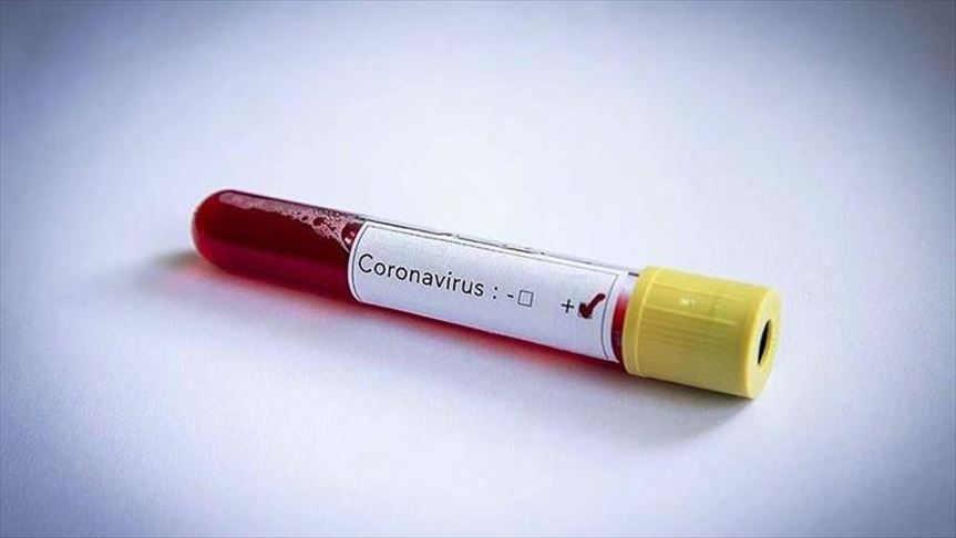 Russia's Coronavirus Cases Rise By 5,849