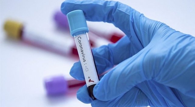 Ermənistanda son 24 saat ərzində koronavirusun 335 yeni halı qeydə alındı