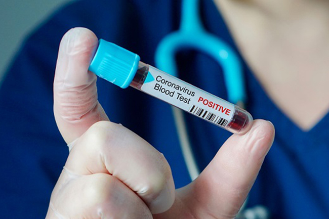 Azərbaycanda son 24 saat ərzində koronavirusa 336 yeni yoluxma halı aşkarlanıb, 5 pasiyent isə vəfat edib
