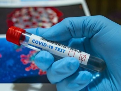 За сутки в Армении было выявлено 662 новых случая коронавируса