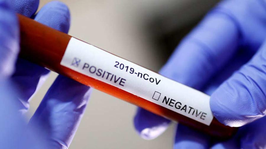 Yeni Zelandiyada koronavirusun bir yeni halı aşkar edildi