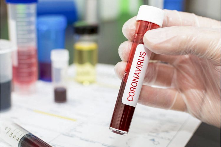 Ukraynada son 24 saat ərzində koronavirusun 1 112 halı aşkar edildi