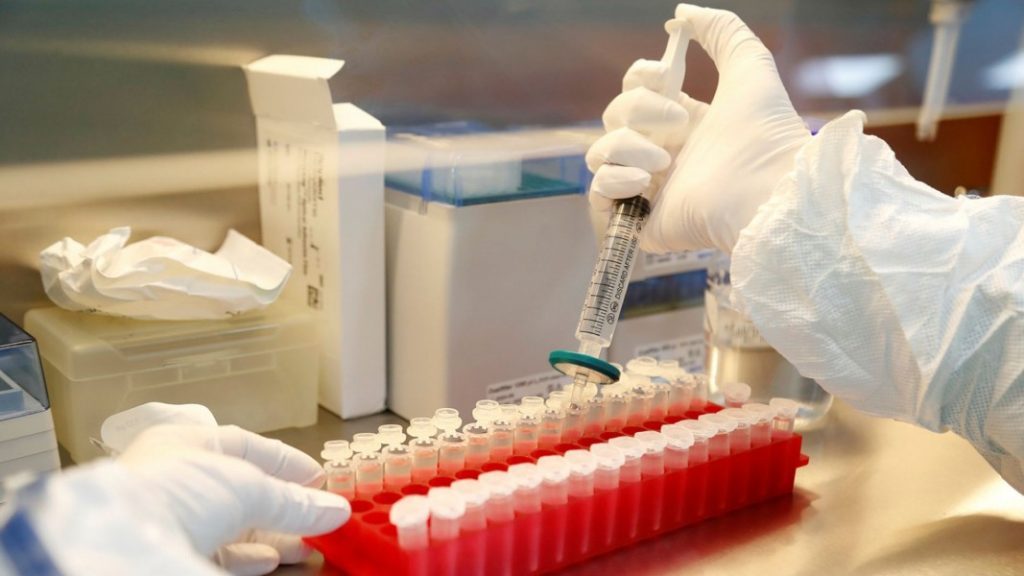 Yaponiyada son 24 saat ərzində koronavirusun 1 540 halı aşkar edildi