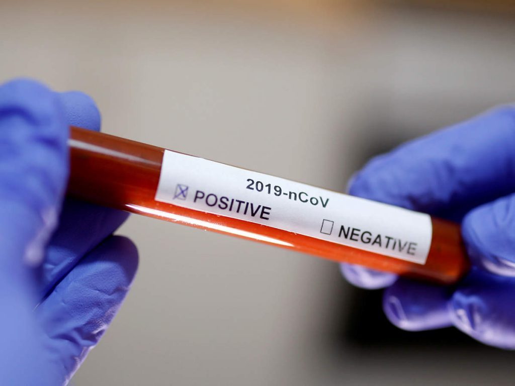В Грузии подтверждено три новых случая коронавируса, а три пациента выздоровели
