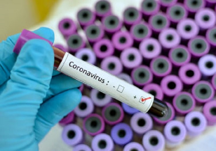 В Армении выявлено 97 новых случаев коронавируса, двое пациентов скончались