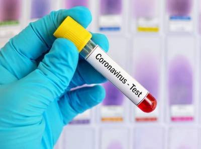 İşğal olunmuş Abxaziyada koronavirusa yoluxmanın 30 yeni halı aşkar edildi