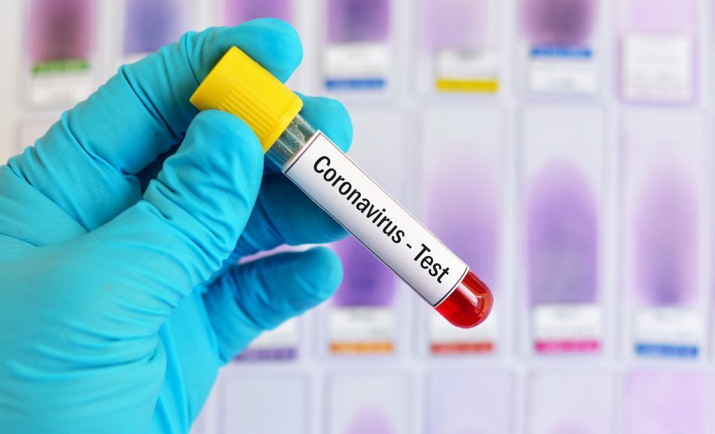 В оккупированной Абхазии зафиксировано 26 новых случаев коронавируса