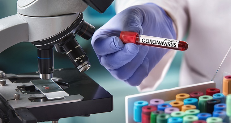 Hollandiyada son 24 saat ərzində koronavirusun 2 544 yeni halı aşkar edildi